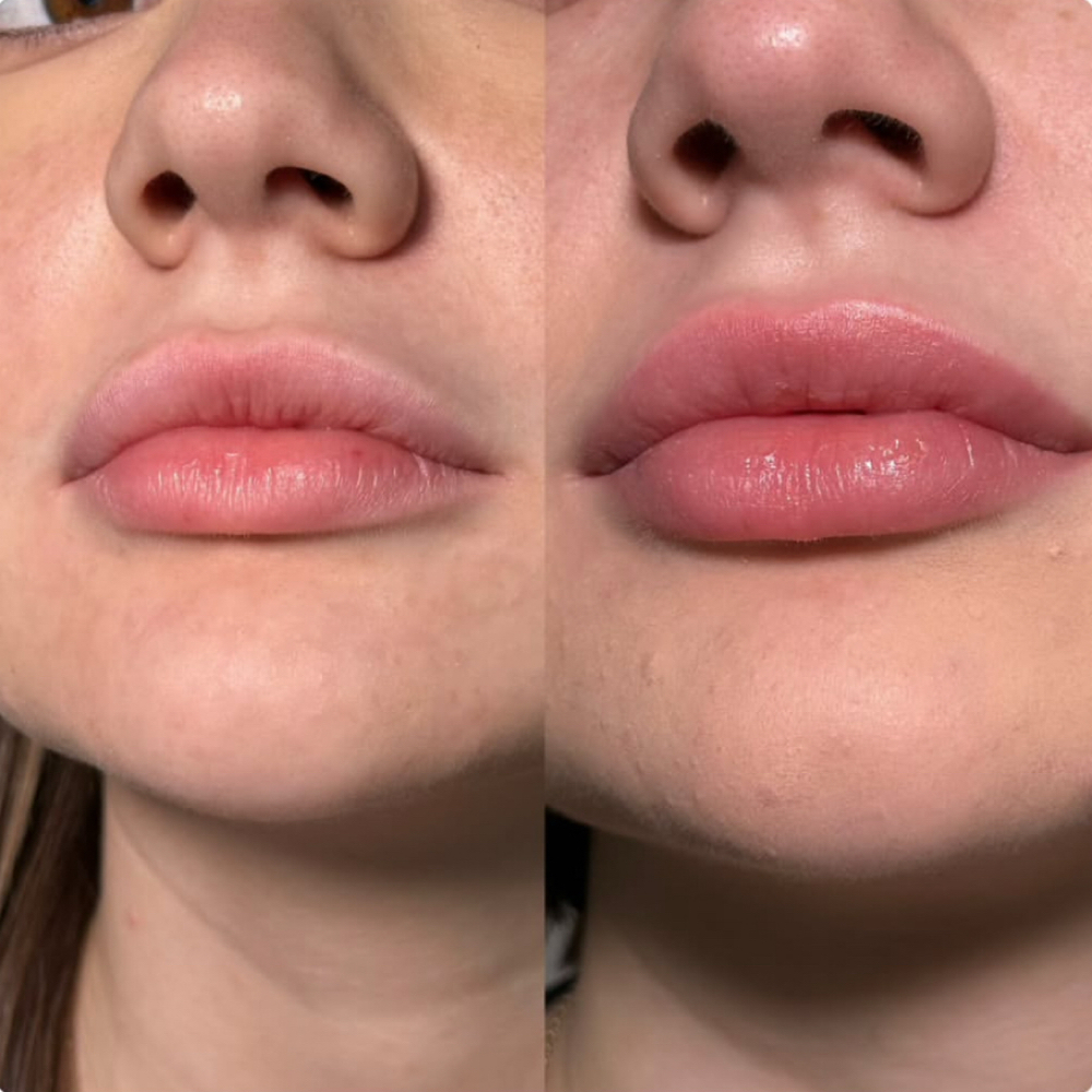 Permanent Makeup (Lip Blush) at Violetta Stankevich in Charlotte, NC