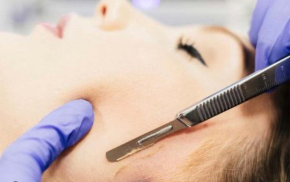 Dermaplaning Facial