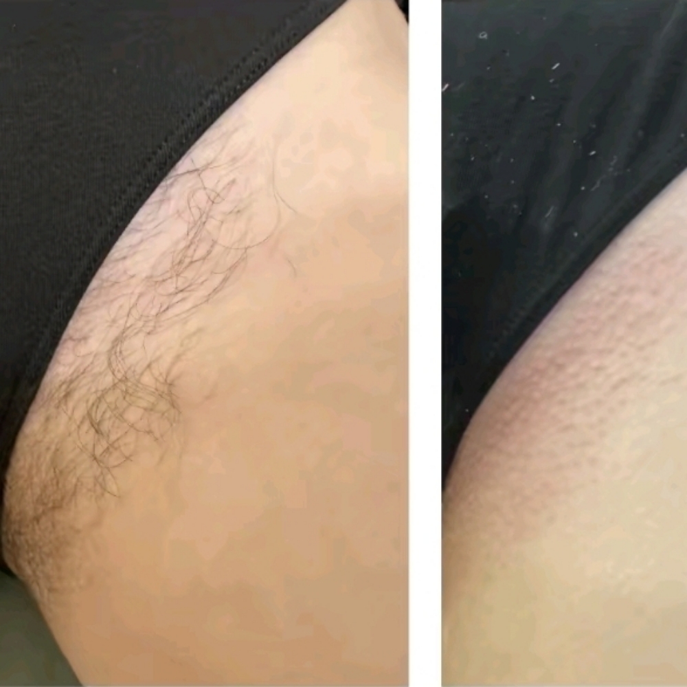 Bikini Line at Belladonna Beauty Waxing & Skincare By Chelsea in Greenville, TX