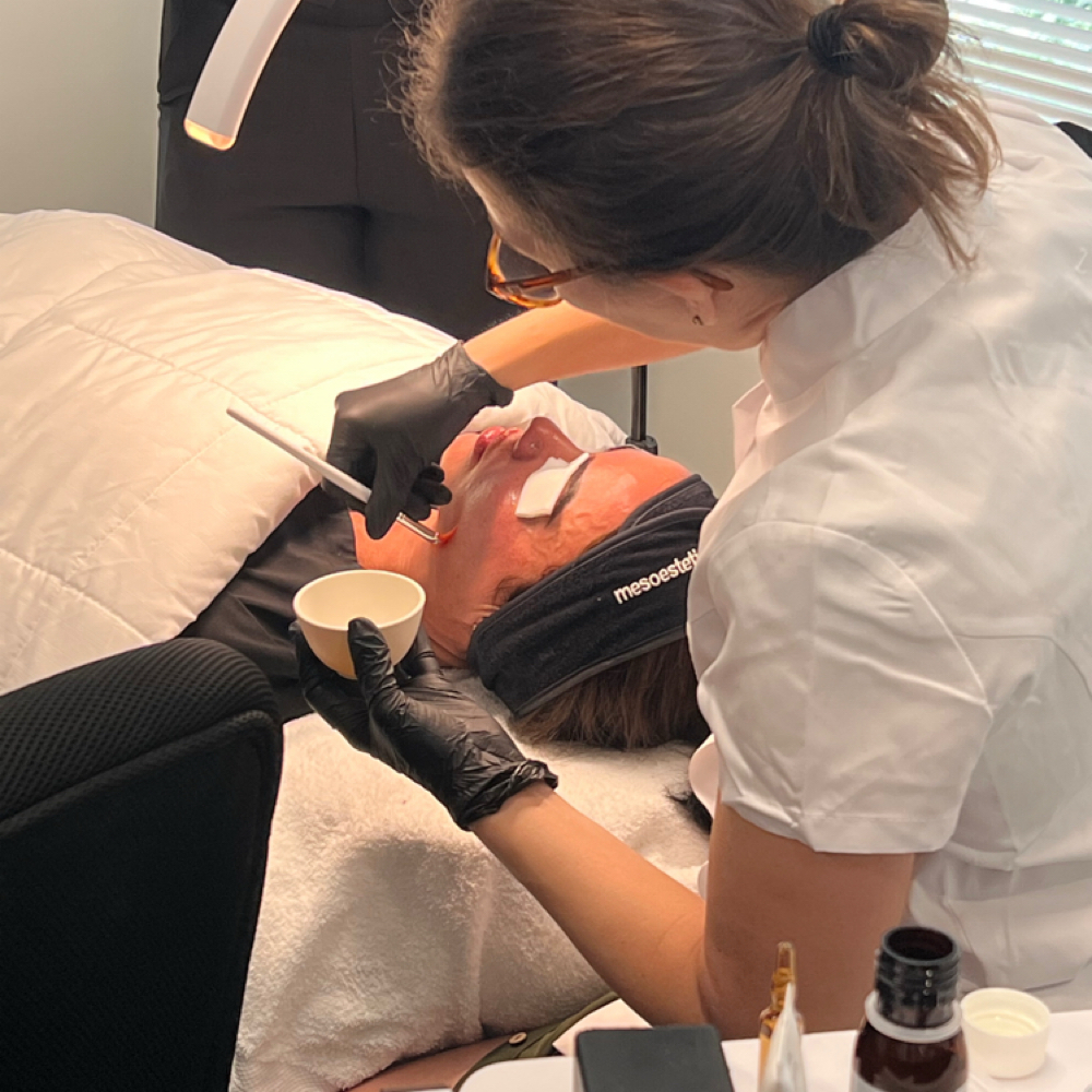 Cosmelan Peel at SiempreBellasBeautySpa in North Miami, FL