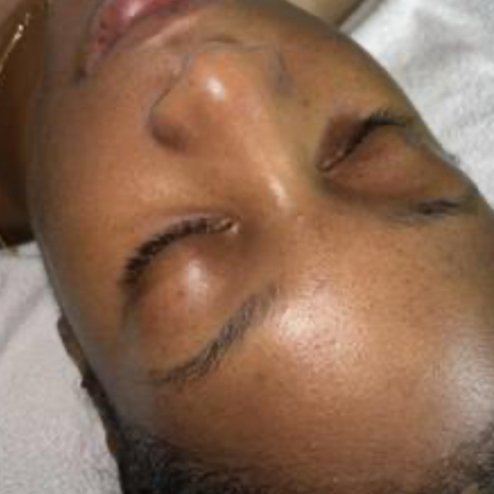 Teen Facial at Sonder Skin in Newport News, VA