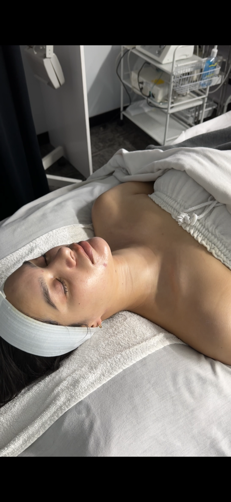NEW CLIENT Consultation & Treatmemt at CYNC Beauty in Long Beach, CA