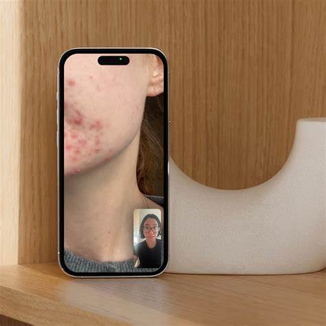 Virtual Skin Analysis + Product Rec at Ashley W. | Skin Care in Venice, FL