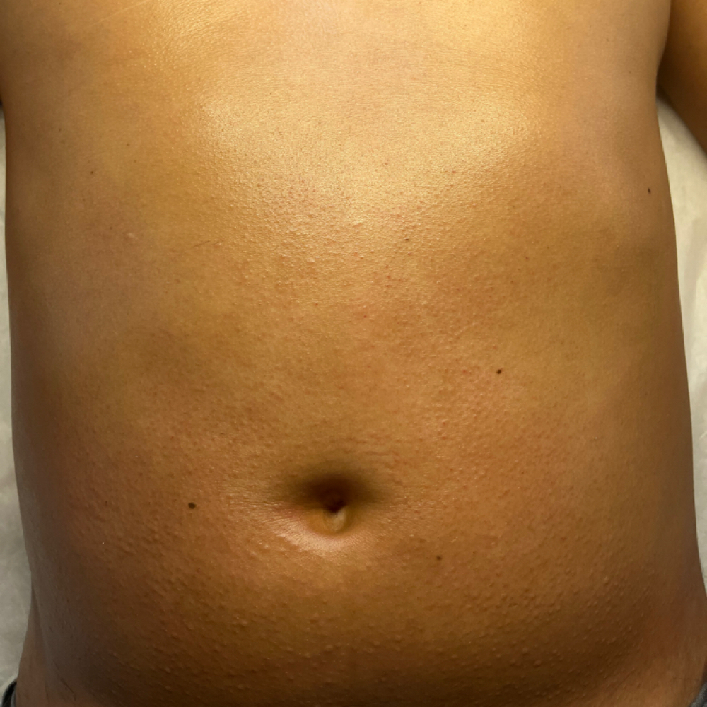 Radiant Belly at Bloom Beauty Esthetics in Salt Lake City, UT