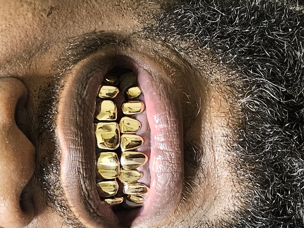 Gold 10k (Snatchouts Only)Per Tooth
