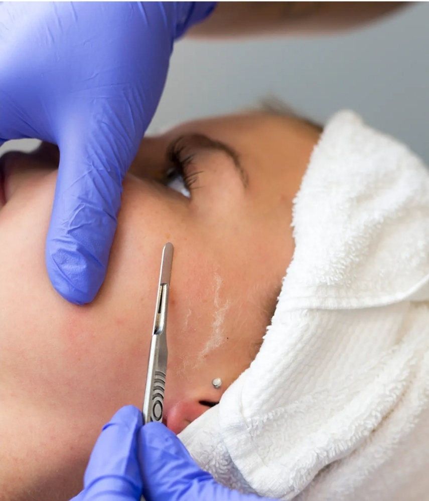 Dermaplaning FACIAL