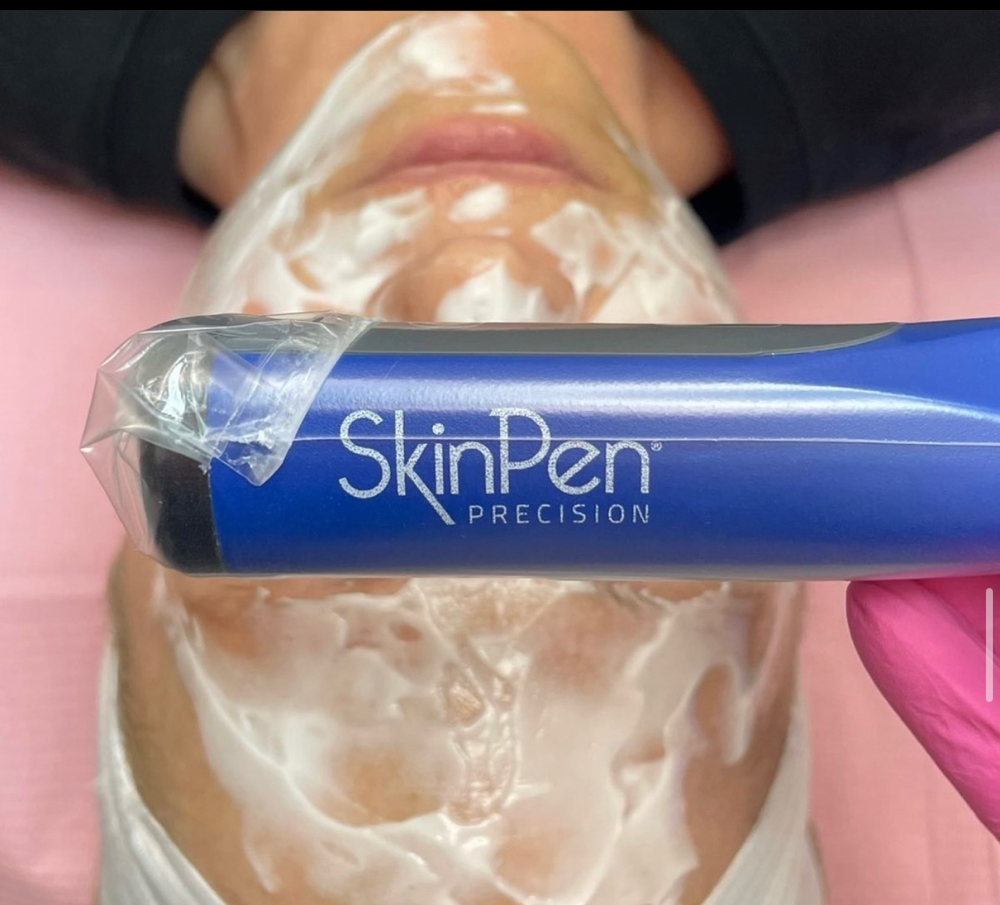 Skin Pen Microneedling Consult!