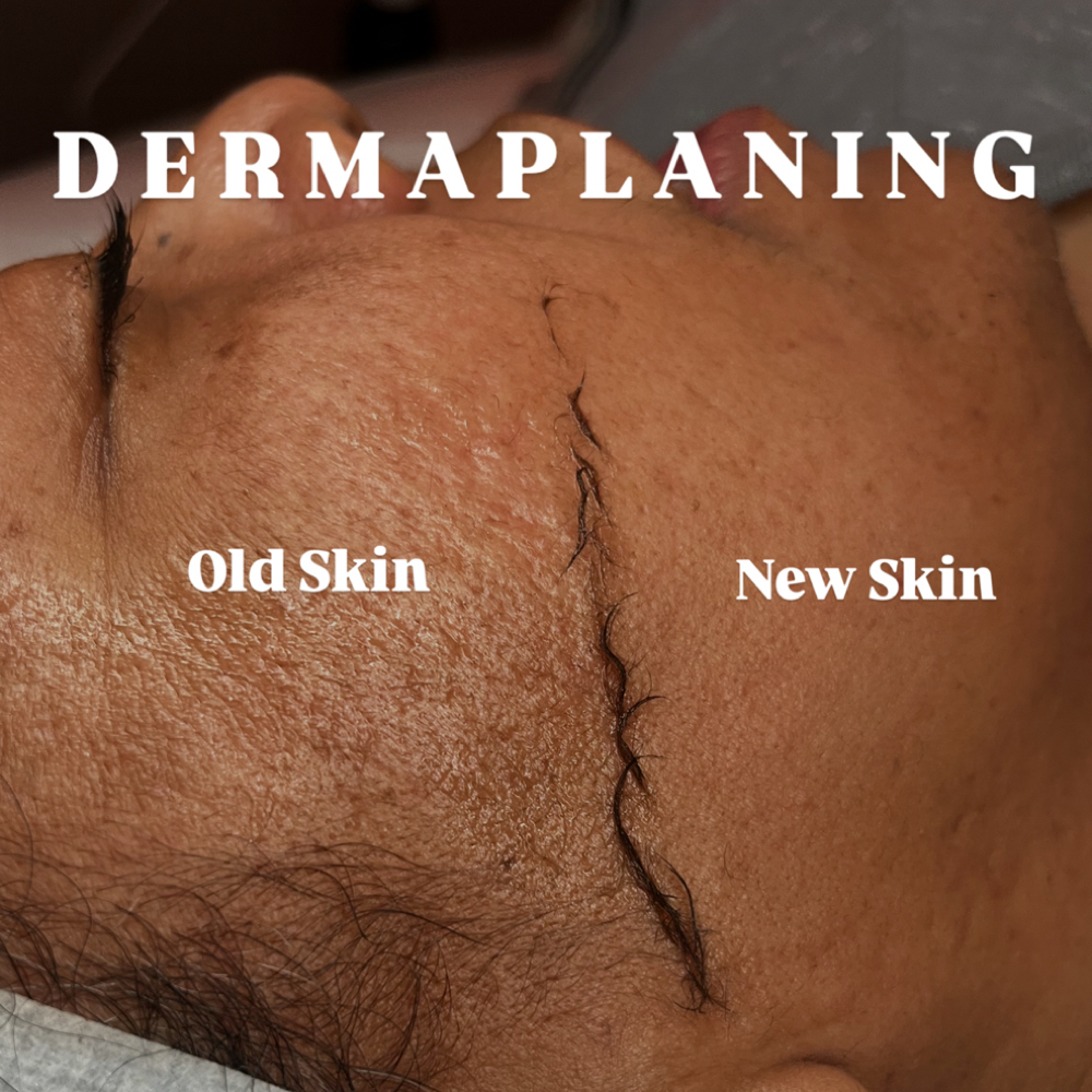 Dermaplane Facial at Euphoria Skin in Chandler, AZ