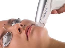 Sublative Skin Resurfacing RF