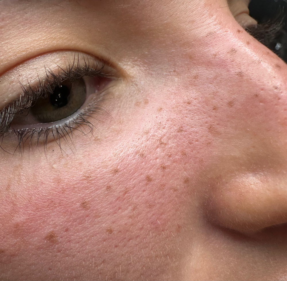 Faux Freckles at Blade Slayed By Syd in Morgantown, WV