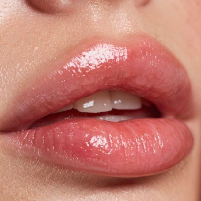 Lip Enhancement (Hialuronic acid) at BEAUTY SPOT in Jacksonville, FL