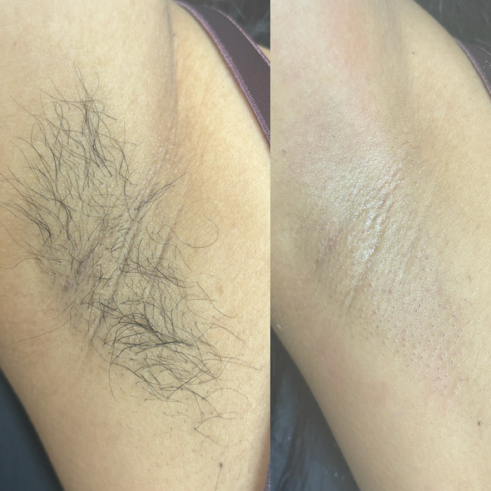 Underarm Wax at Minks And Skin in Fresno, CA