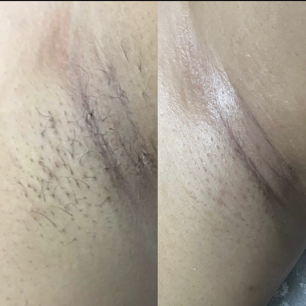 Underarm Wax
