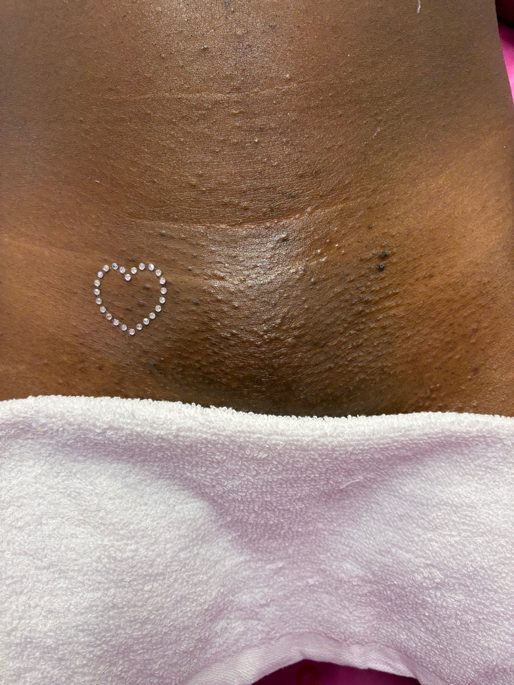 Vajazzle Add-On