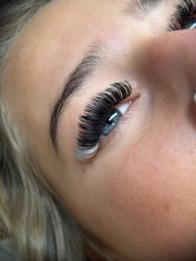 Volume Fill at KES Esthetics in Fairmont, WV