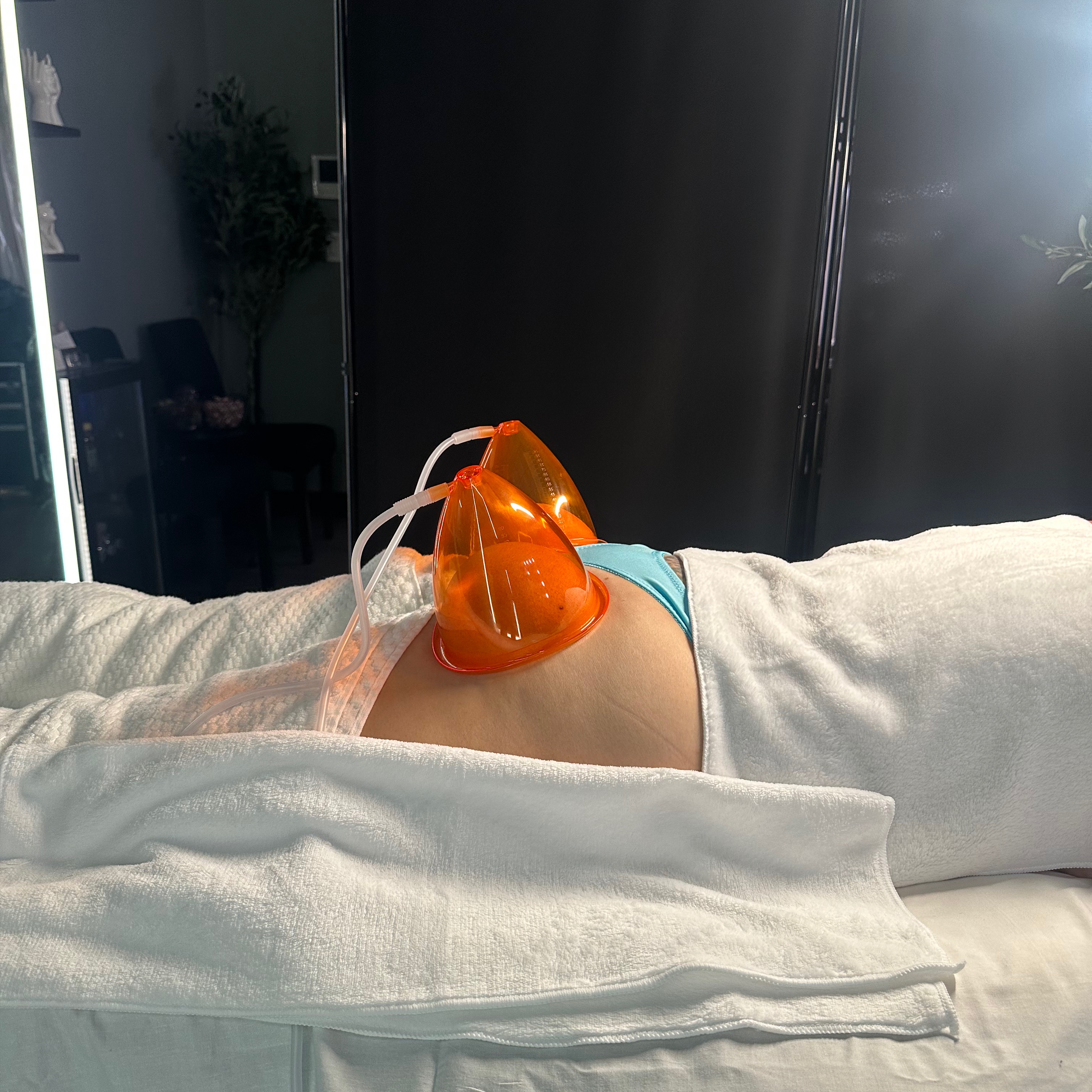 Vacuum Therapy at T&N Skin Med Spa Inc in Abington, PA