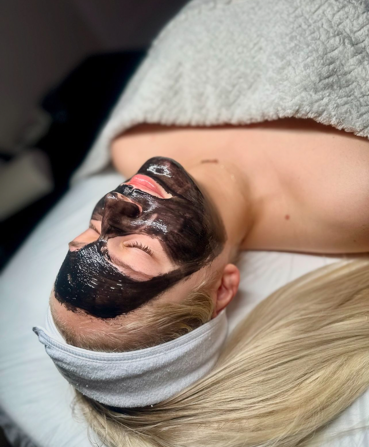 ACNE + DETOX FACIAL