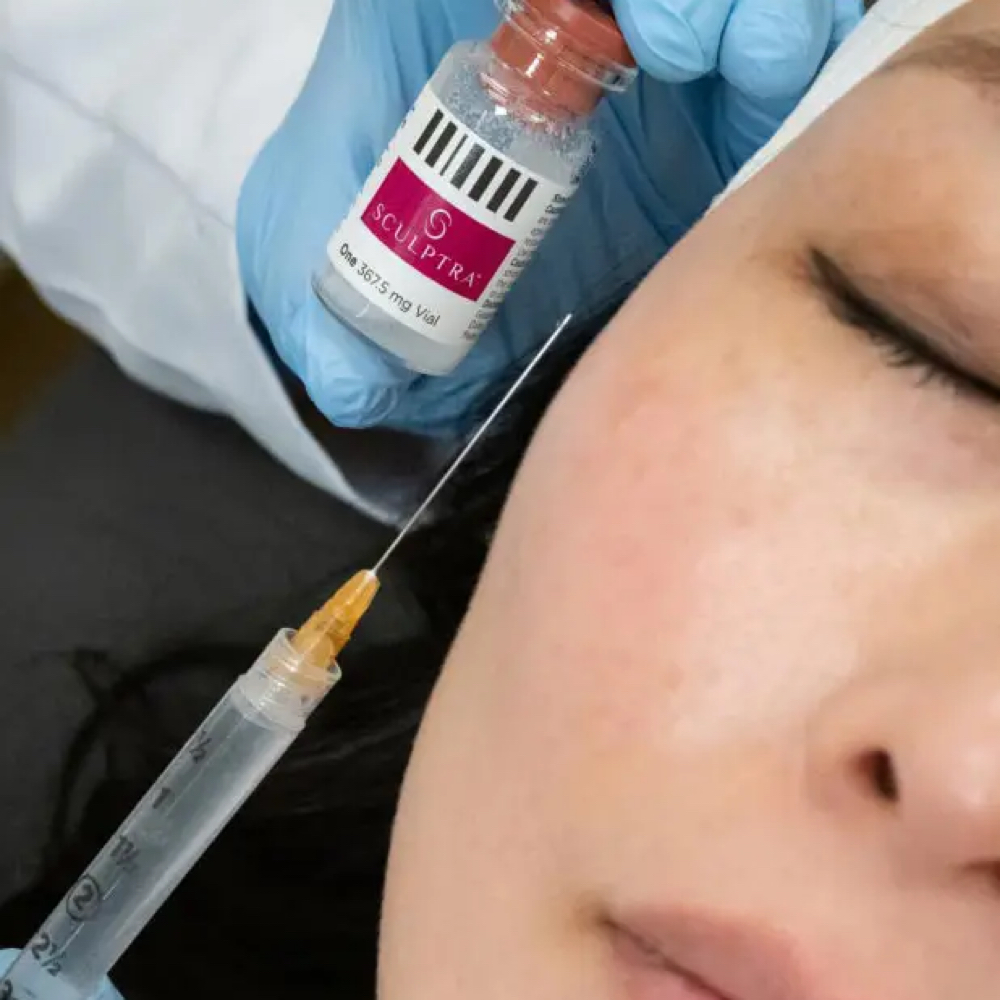 Sculptra at Arcana Med Spa in Castle Rock, CO
