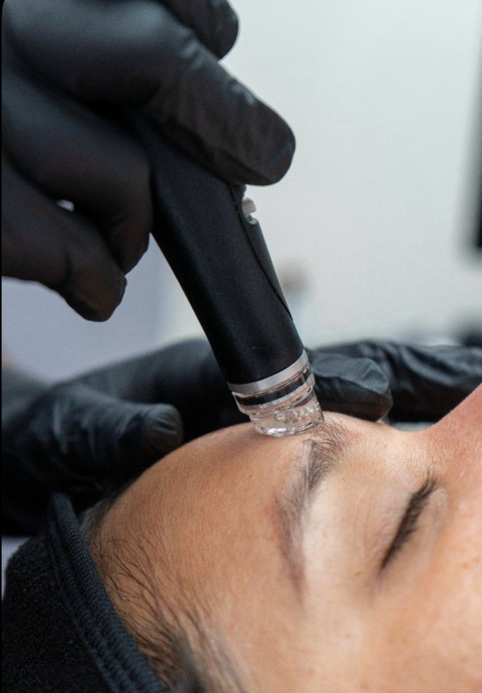 Mini Hydrafacial