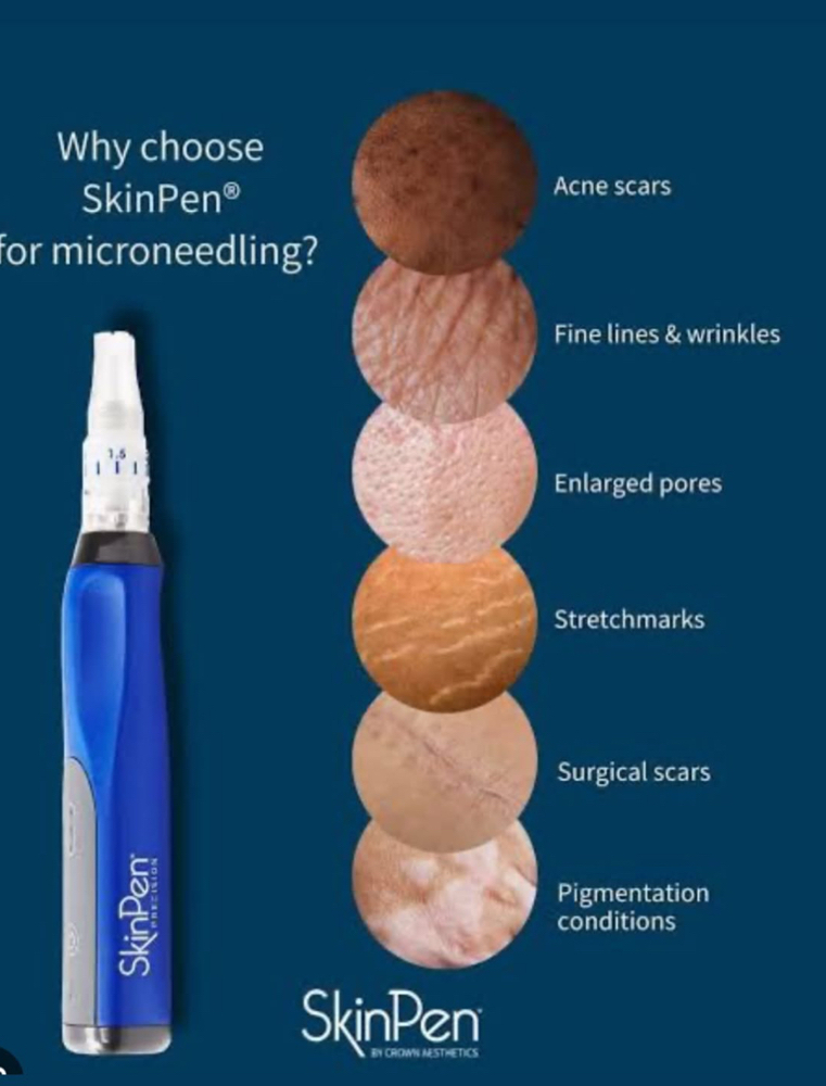 Skin Pen Microneedling