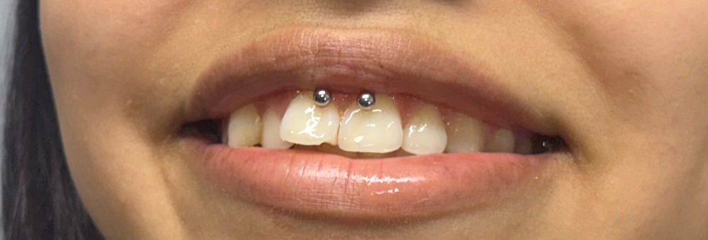 Smiley