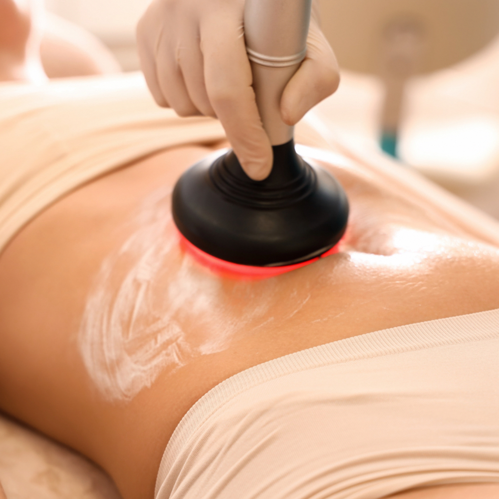 Non-Invasive Lipo (Cavitation)