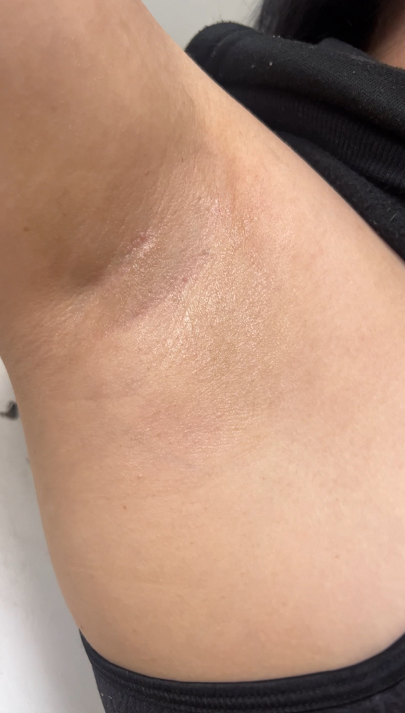 Underarm Wax