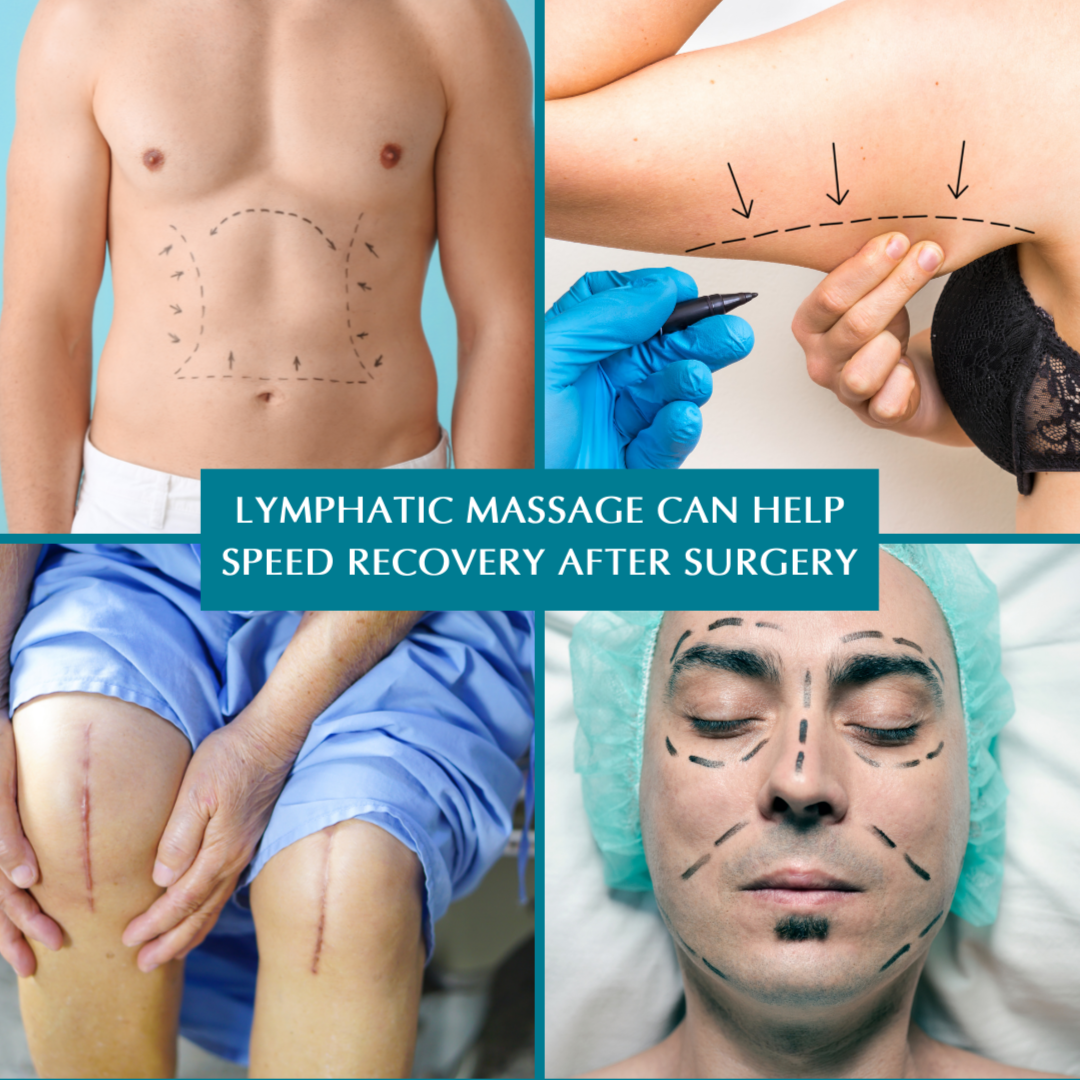 Post-op Manual Lymphatic Drainage