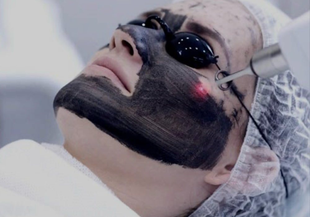 HOLLYWOOD PEEL