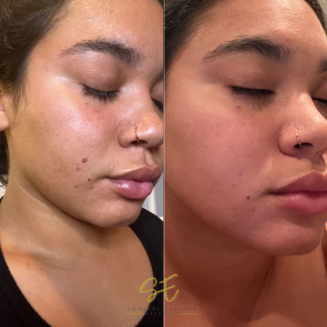 Mr. Lulu Double Peel Facial