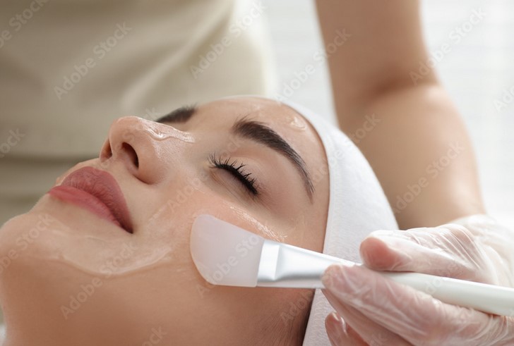 Lactic Chemical Peel