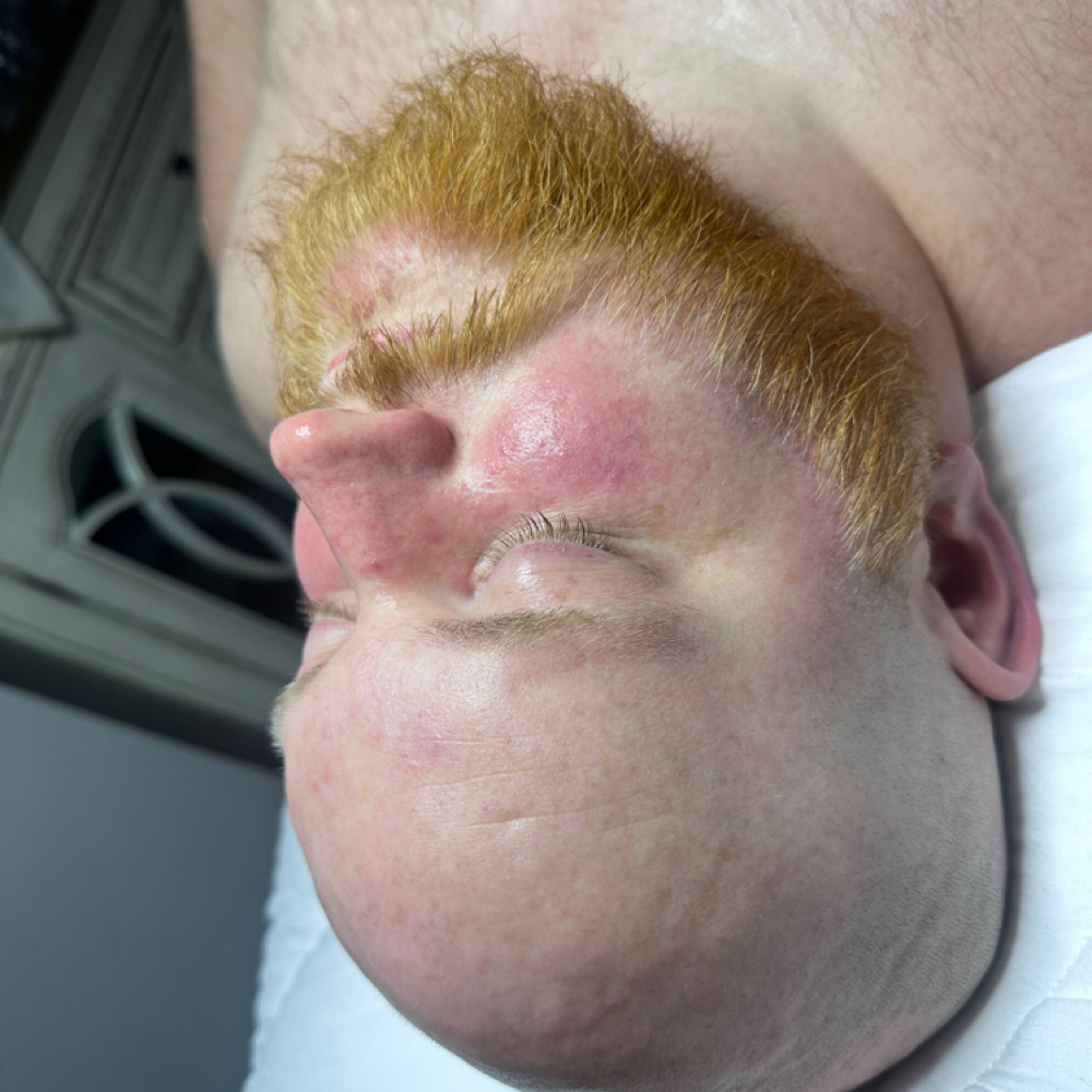 Therapy Session at The Beauty Bank in Oklahoma City, OK