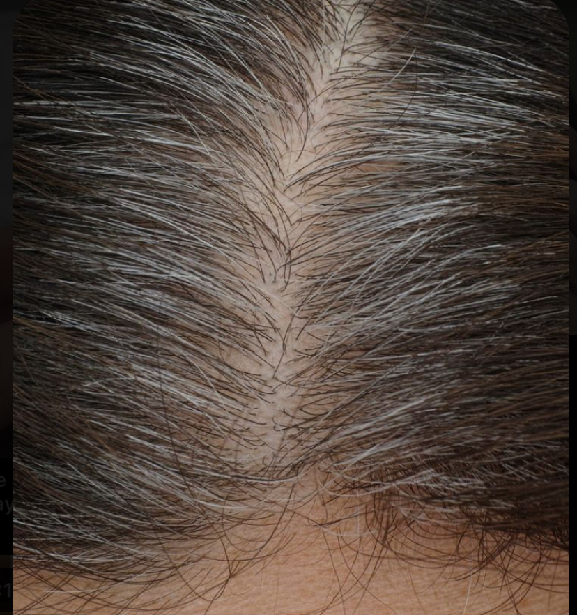 Root Touch Up