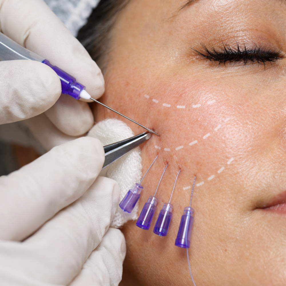 Pdo Threats/ Hilos Tensores Med at Beauty Couture MedSpa in Austin, TX