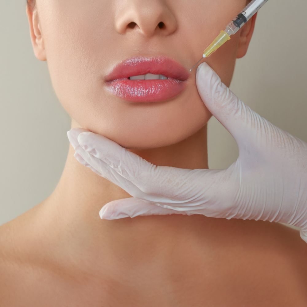 Lip Filler