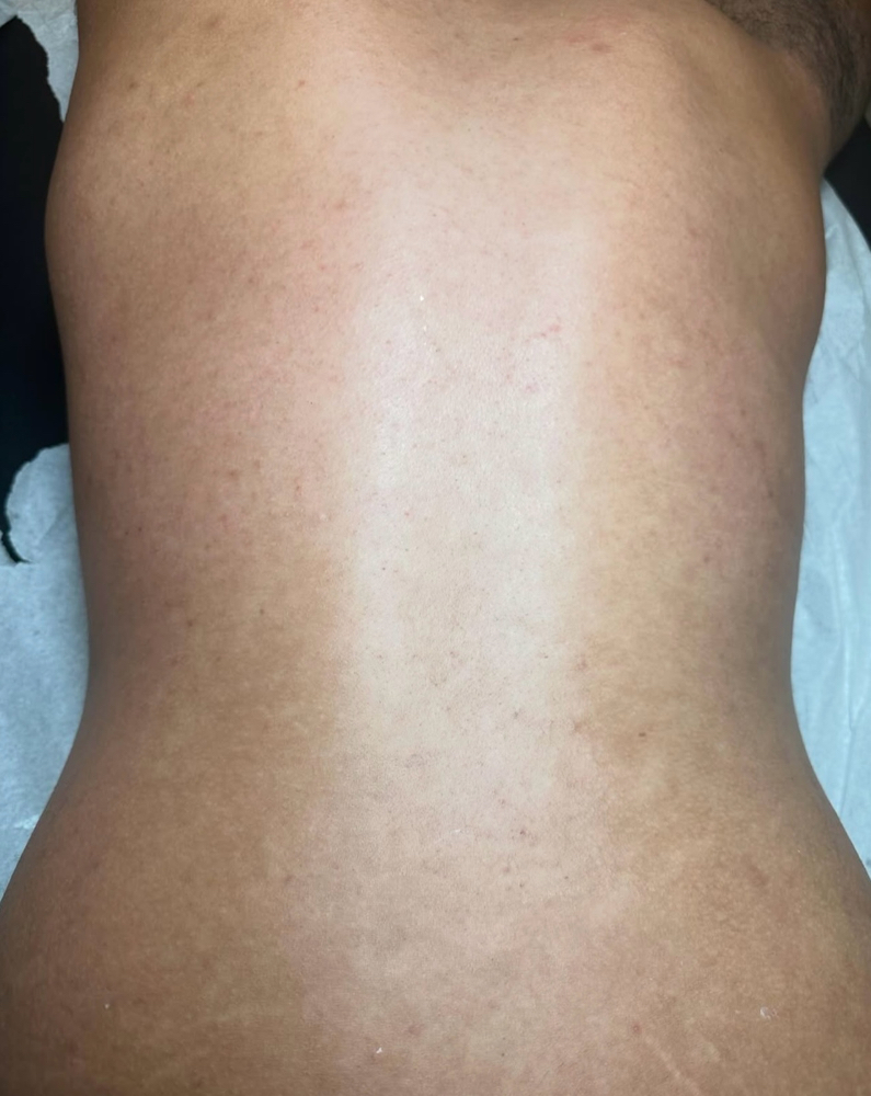 Full Back Wax