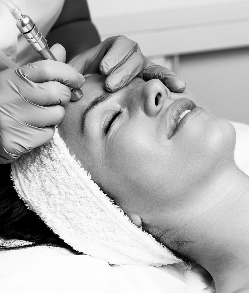 Microdermabrasion Facial