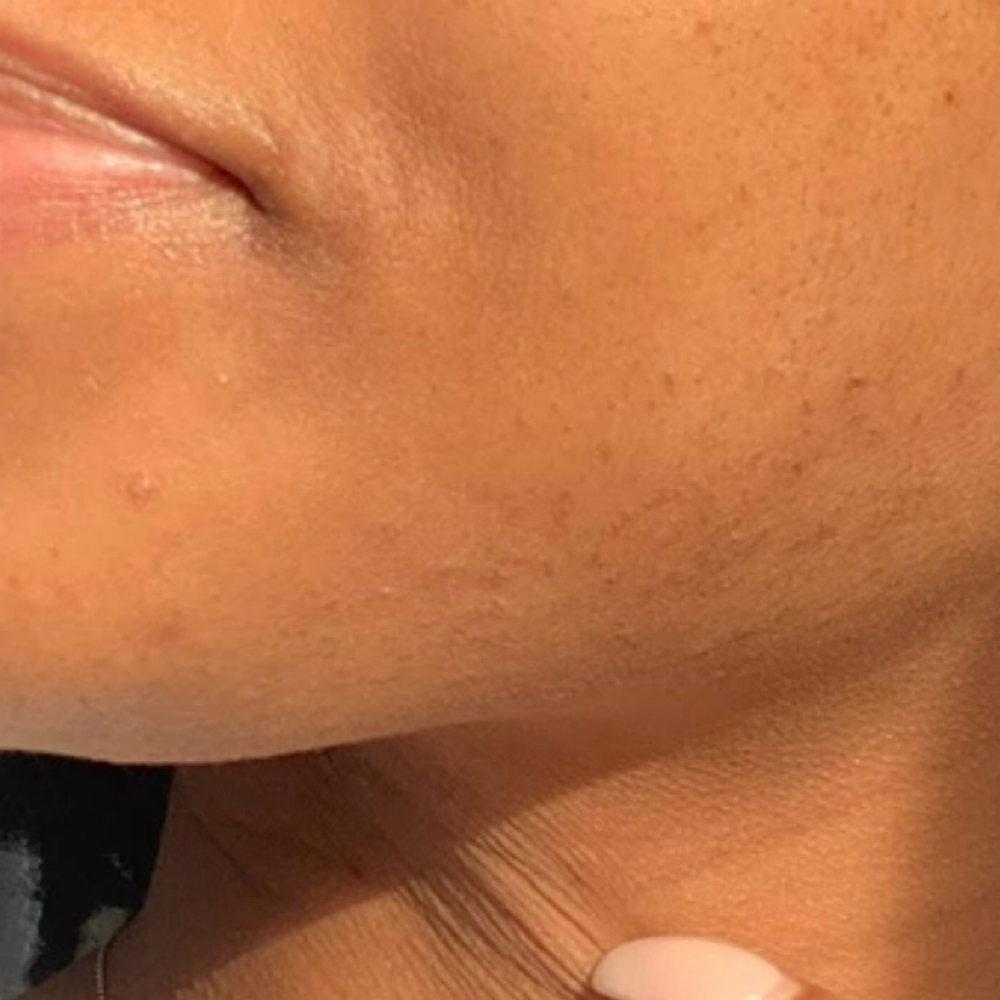 Chin Wax at Ana Aesthetic & Beauty in Freeport, NY