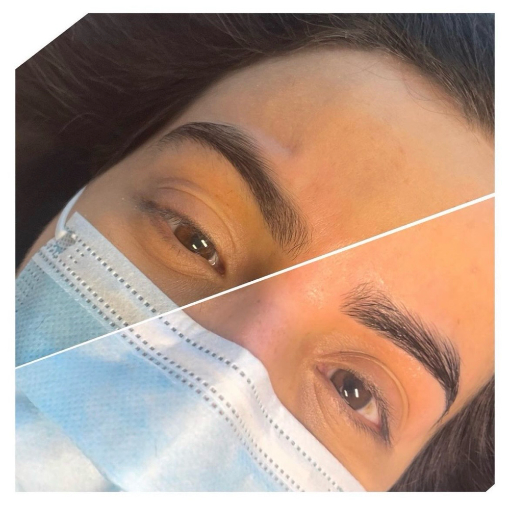 Brow shaping