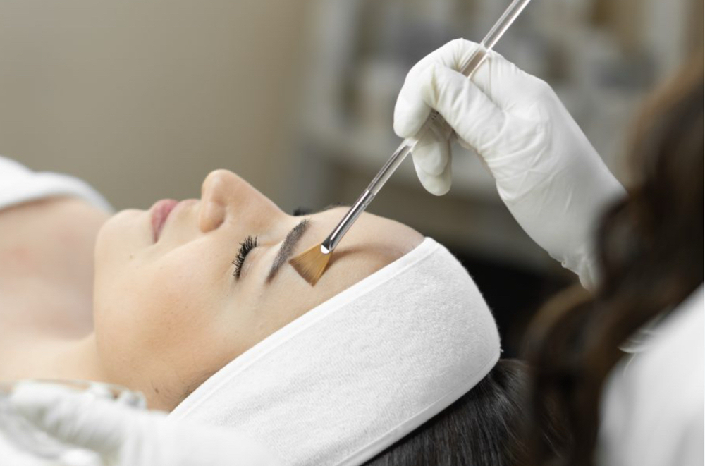 Custom Chemical Peel
