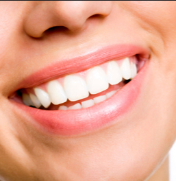 $75 Black Friday Gentle whitening