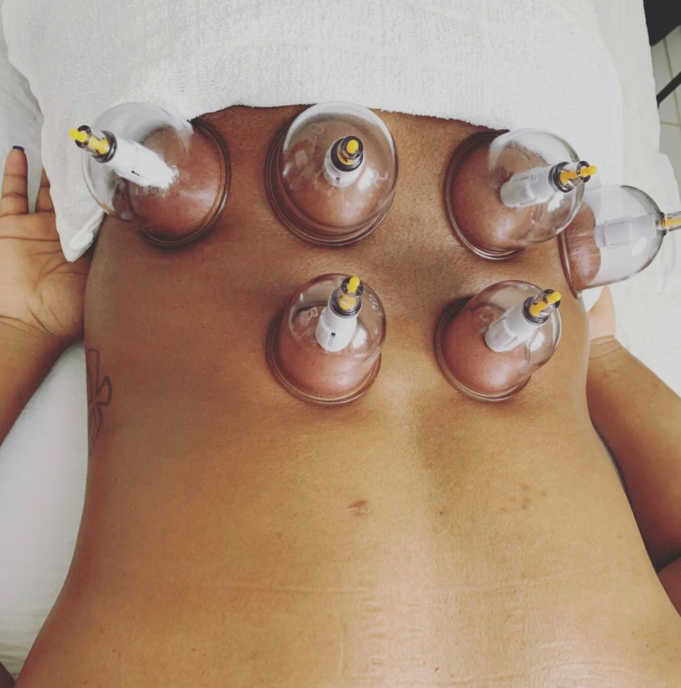 Therapeutic Cupping Restoration at Azura Natural Wellness in Highland, IN