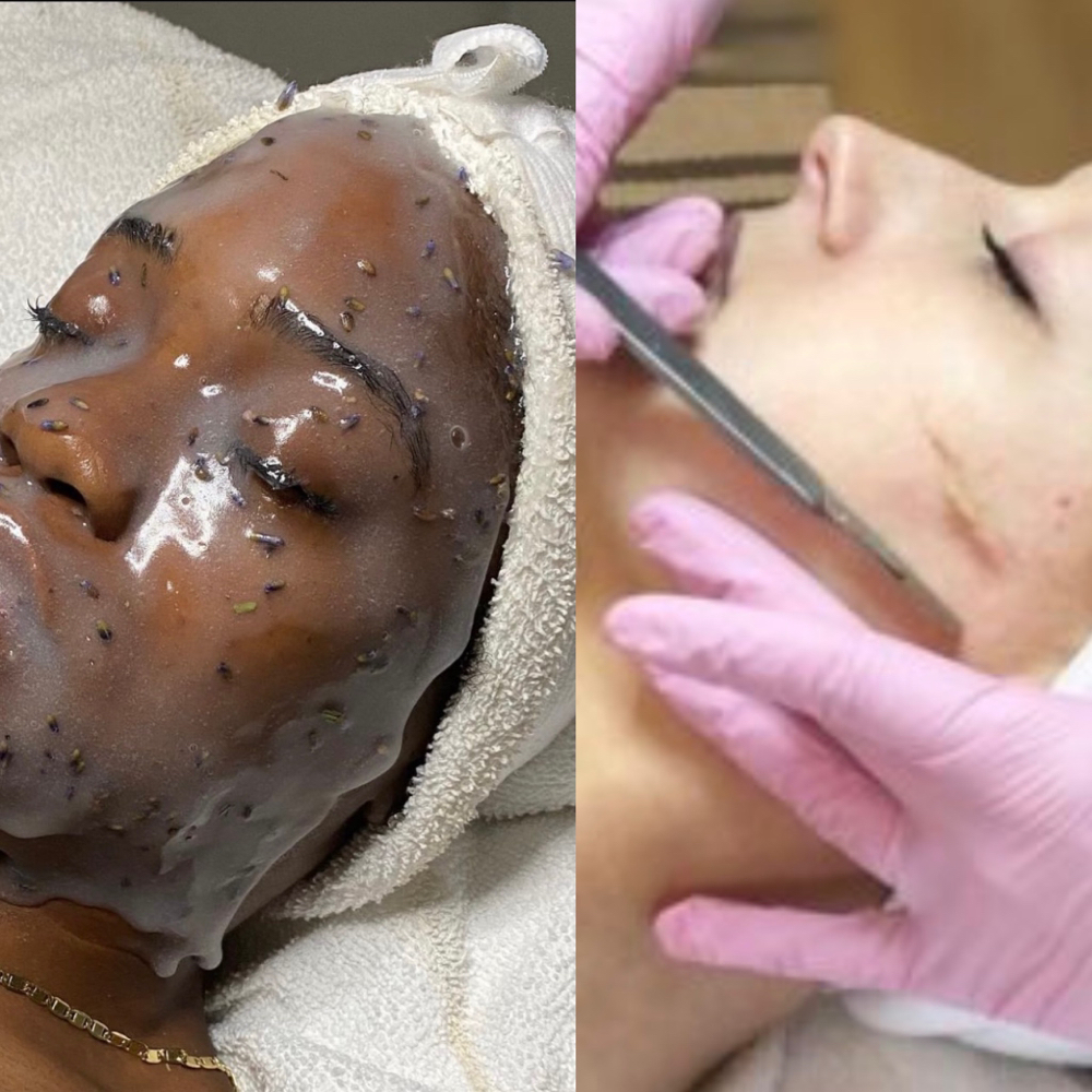 Dermaplane Facial