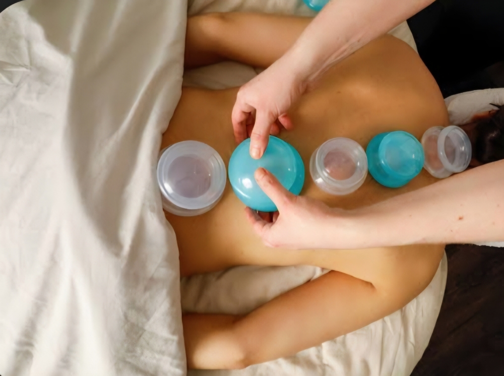 Neuromuscular Cupping Therapy