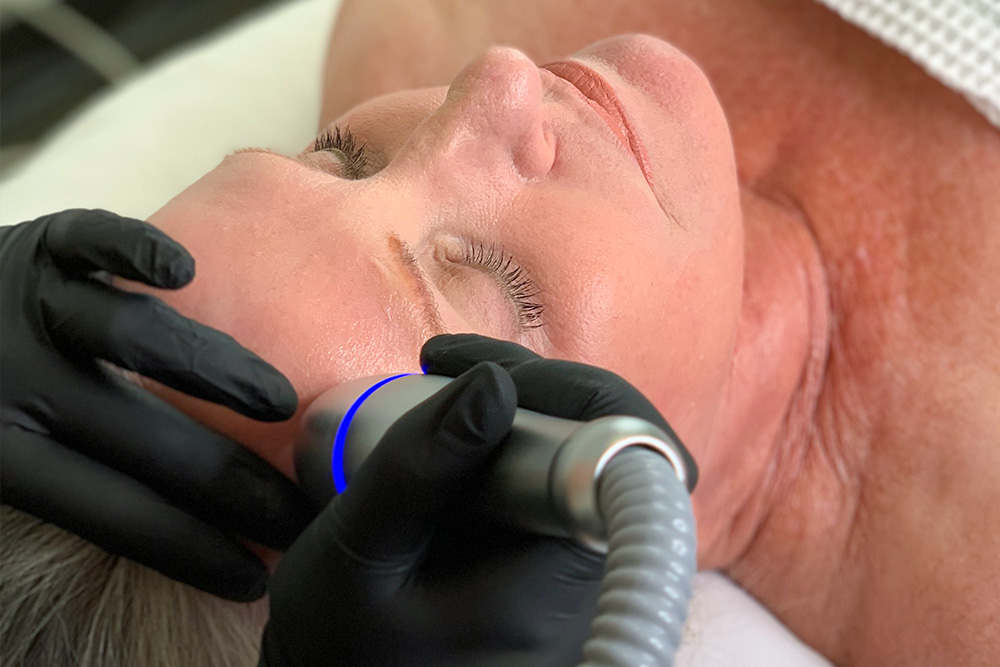 Cold Therapy Facial Toning