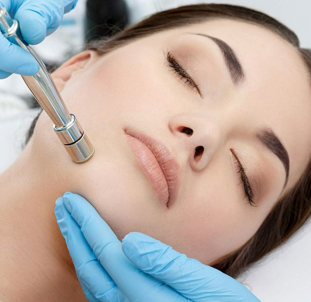 Microdermabrasion