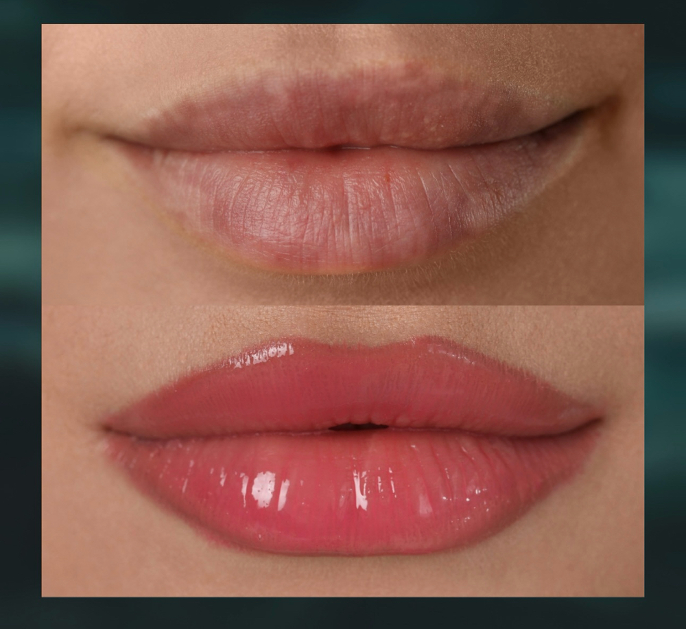 Lip Blushing