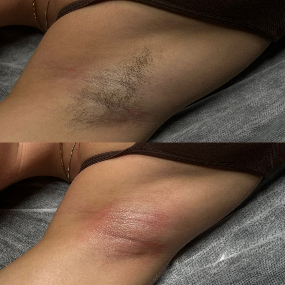 Underarm Wax
