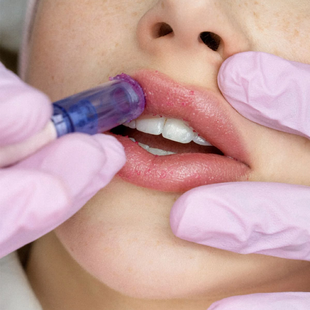 Hydralips + Vitamin C at vallusa skincare & brows in miami, FL