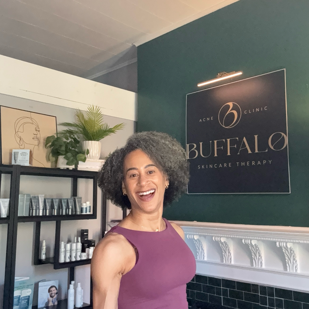 Acne Boot Camp Consultation at Buffalo Skincare Therapy in Buffalo, NY